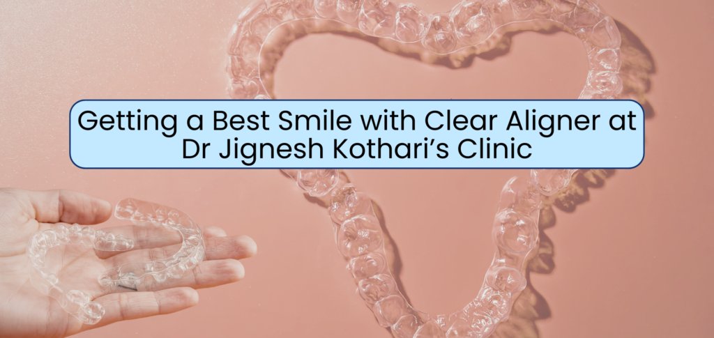 How Clear Aligners Get The Best Smile - invisiblebraces