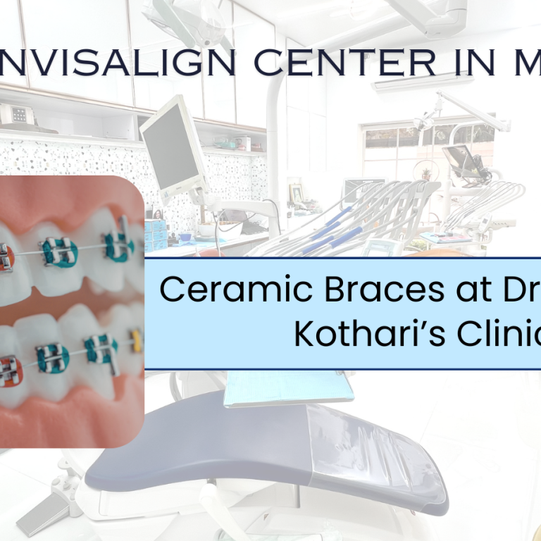 Ceramic Braces