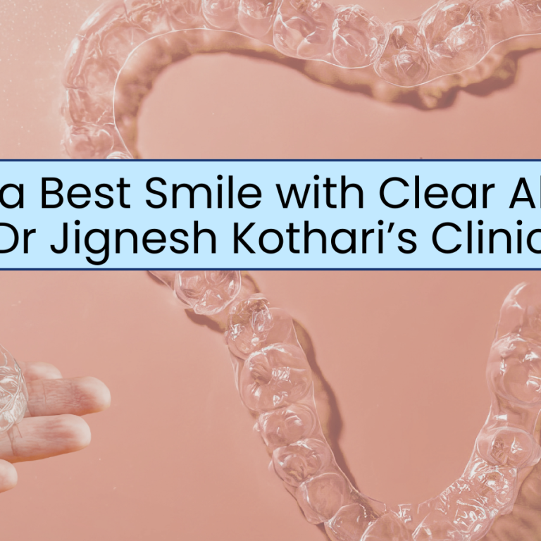 How Clear Aligners Get The Best Smile
