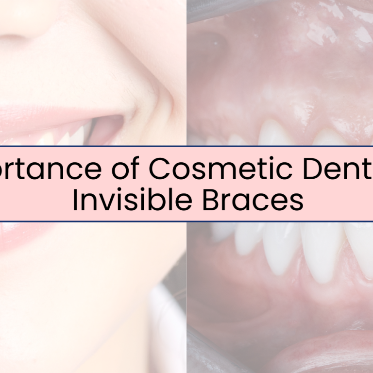 Importance of Cosmetic Dentistry