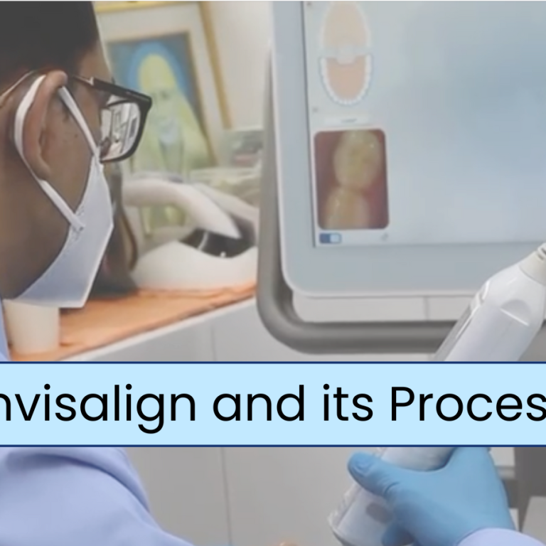 Invisalign and its Process