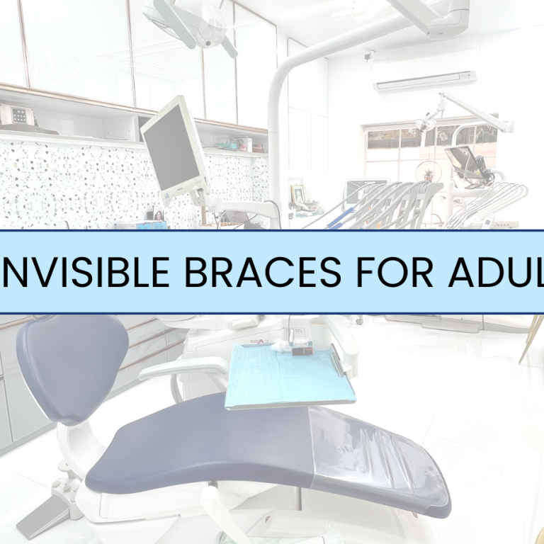 Invisible Braces For Adults
