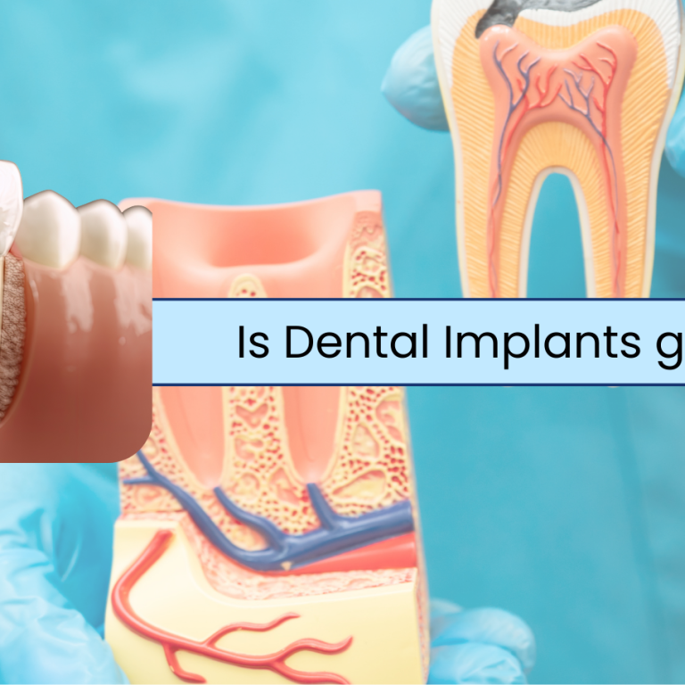 Is dental implants good for