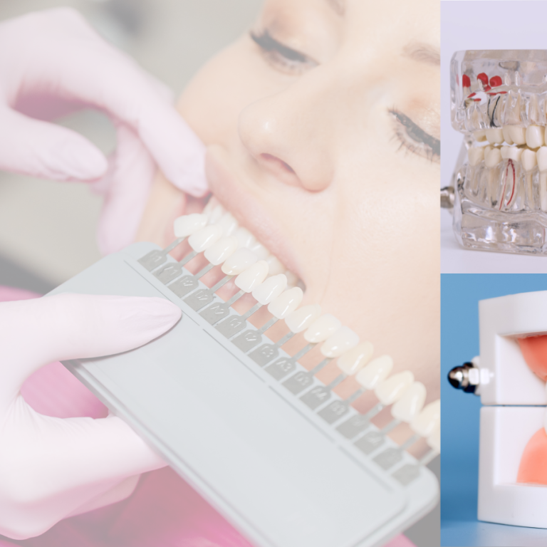 What Defines Cosmetic Dentistry