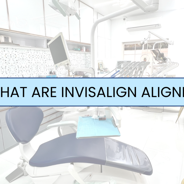 What are Invisalign Aligners